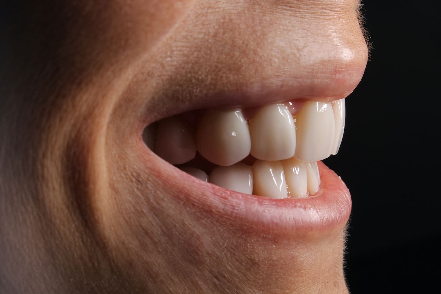 Implantes dentales con carga inmediata en Palma de Mallorca: dientes fijos el mismo día, sedación consciente y diseño digital 3D. Contáctanos