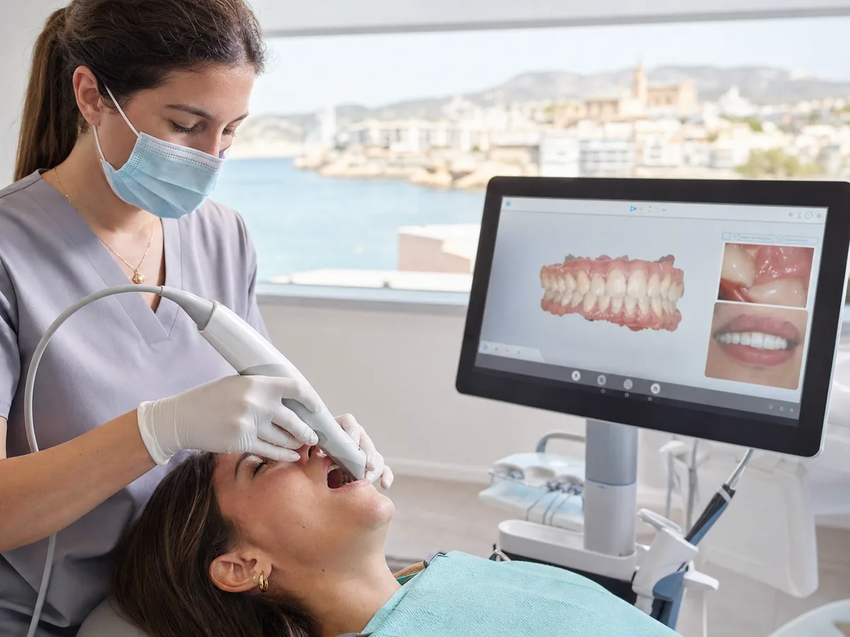 Diseño digital de sonrisa — guía de Clinicdent, Mallorca